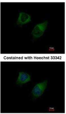 Immunocytochemistry/ Immunofluorescence: DGK-gamma Antibody [NBP1-33055]