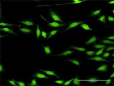 Immunocytochemistry/ Immunofluorescence: DGK-zeta Antibody [H00008525-D01P]