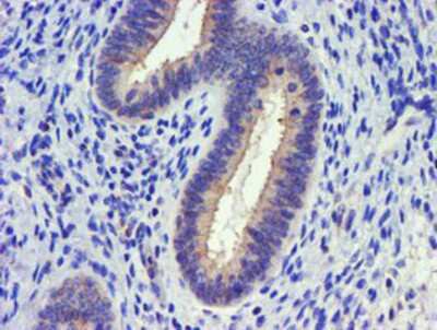 Immunohistochemistry-Paraffin: DGK-alpha Antibody (OTI4A11) [NBP2-01597]