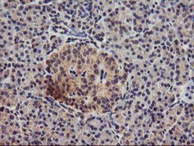 Immunohistochemistry-Paraffin: DGK-alpha Antibody (OTI4A11) [NBP2-01597]