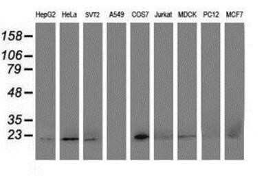 Flow Cytometry: DHFRL1 Antibody (OTI1E2) - Azide and BSA Free [NBP2-72459]