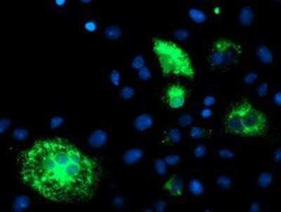 Immunocytochemistry/ Immunofluorescence: DHFRL1 Antibody (OTI1E2) [NBP2-01019]