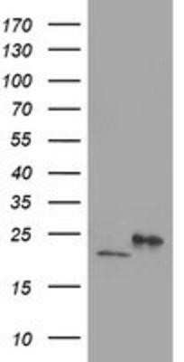 Western Blot: DHFRL1 Antibody (OTI1E2) [NBP2-01019]