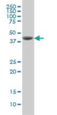 Western Blot: DHODH Antibody (6E1) [H00001723-M01]