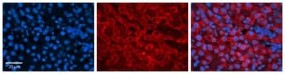 Immunohistochemistry: DHODH Antibody [NBP1-59593]