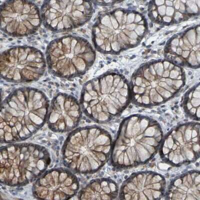 Immunohistochemistry-Paraffin: DHODH Antibody [NBP1-86097]