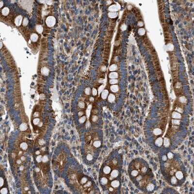 Immunohistochemistry-Paraffin: DHODH Antibody [NBP1-86110]
