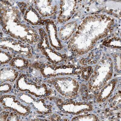 Immunohistochemistry-Paraffin: DHODH Antibody [NBP1-86110]