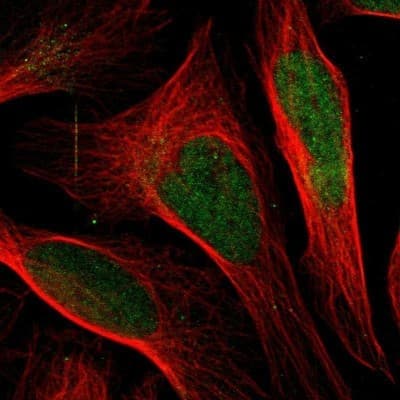 Immunocytochemistry/ Immunofluorescence: DHPS Antibody [NBP1-82649]