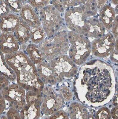 Immunohistochemistry-Paraffin: DHPS Antibody [NBP1-82649]