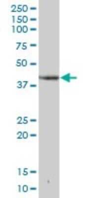 Western Blot: DHPS Antibody [H00001725-B02P]