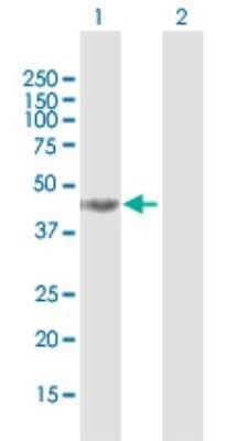 Western Blot: DHPS Antibody [H00001725-B02P]