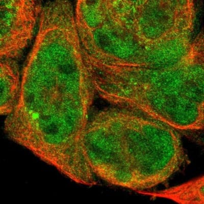 Immunocytochemistry/ Immunofluorescence: DHRS1 Antibody [NBP1-83560]