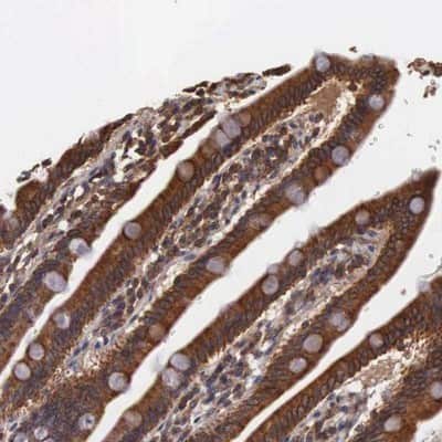 Immunohistochemistry-Paraffin: DHRS1 Antibody [NBP1-83560]