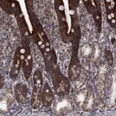 Immunohistochemistry-Paraffin: DHRS1 Antibody [NBP3-17027]
