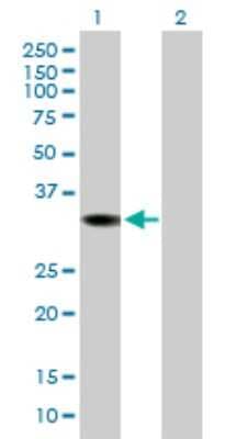 Western Blot: DHRS1 Antibody [H00115817-B01P]