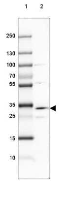 Western Blot: DHRS1 Antibody [NBP1-83560]