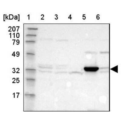Western Blot: DHRS1 Antibody [NBP1-83560]