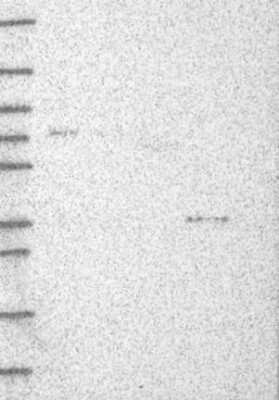 Western Blot: DHRS1 Antibody [NBP3-17027]