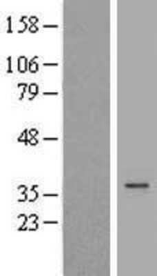 Western Blot: DHRS1 Overexpression Lysate [NBL1-09865]