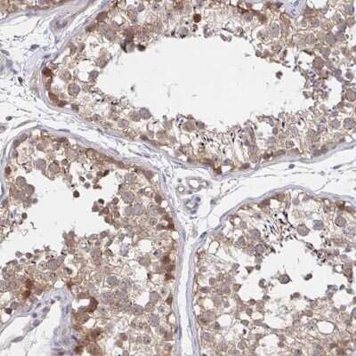 Immunohistochemistry-Paraffin: DHRS12 Antibody [NBP2-37961]