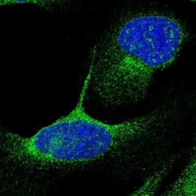 Immunocytochemistry/ Immunofluorescence: DHRS13 Antibody [NBP1-81163]