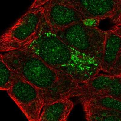 Immunocytochemistry/ Immunofluorescence: DHRS2 Antibody [NBP2-56196]