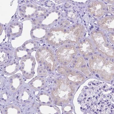 Immunohistochemistry-Paraffin: DHRS2 Antibody [NBP2-49605]