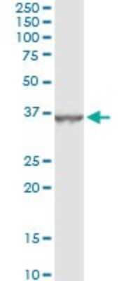 Immunoprecipitation: DHRS9 Antibody (3E3) [H00010170-M06]