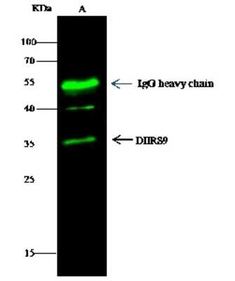 Immunoprecipitation: DHRS9 Antibody [NBP2-97017]