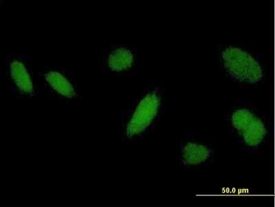 Immunocytochemistry/ Immunofluorescence: DHRSX Antibody [H00207063-B01P]