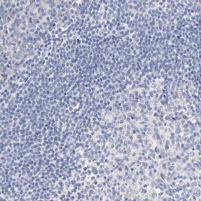 Immunohistochemistry-Paraffin: DHRSX Antibody [NBP1-85219]
