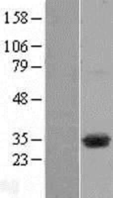 Western Blot: DHRSX Overexpression Lysate [NBP2-05502]