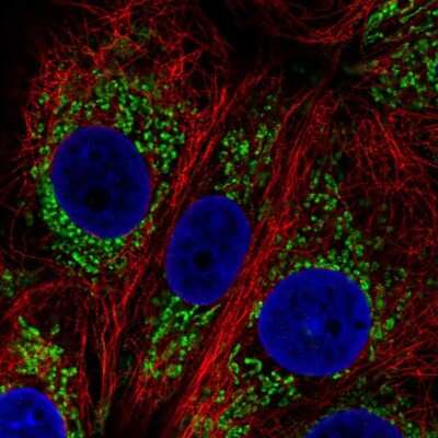 Immunocytochemistry/ Immunofluorescence: DHTKD1 Antibody [NBP2-55215]