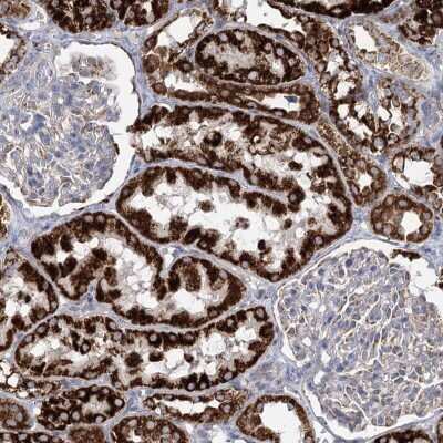 Immunohistochemistry-Paraffin: DHTKD1 Antibody [NBP2-55215]