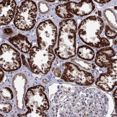 Immunohistochemistry-Paraffin: DHTKD1 Antibody [NBP2-57835]