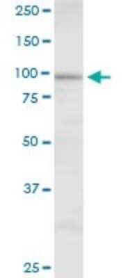 Western Blot: DHTKD1 Antibody [H00055526-B01P]