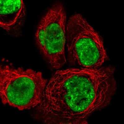 Immunocytochemistry/ Immunofluorescence: DHX15 Antibody [NBP2-13919]