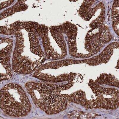 Immunohistochemistry-Paraffin: DHX29 Antibody [NBP1-85272]