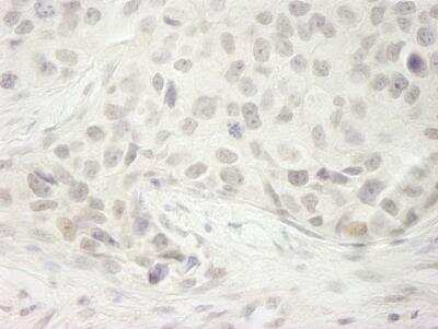 Immunohistochemistry: DHX33 Antibody [NB100-2580]