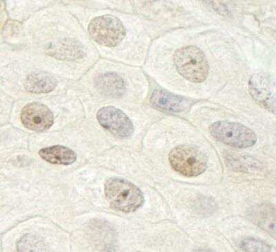 Immunohistochemistry: DHX33 Antibody [NB100-2580]