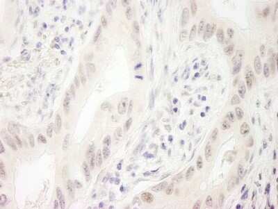 Immunohistochemistry-Paraffin: DHX33 Antibody [NB100-2580]