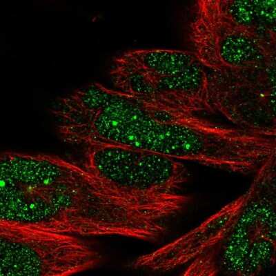 Immunocytochemistry/ Immunofluorescence: DHX35 Antibody [NBP2-57313]