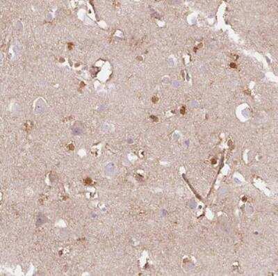 Immunohistochemistry: DHX35 Antibody [NBP2-30588]