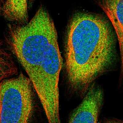 Immunocytochemistry/ Immunofluorescence: DHX36 Antibody [NBP1-84286]
