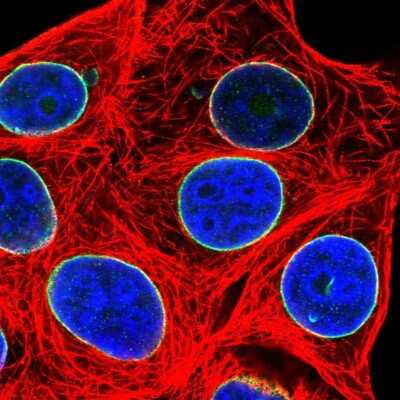 Immunocytochemistry/ Immunofluorescence: DHX37 Antibody [NBP2-13922]