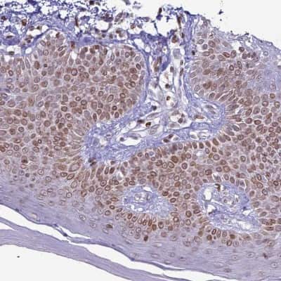 Immunohistochemistry-Paraffin: DHX37 Antibody [NBP2-13922]
