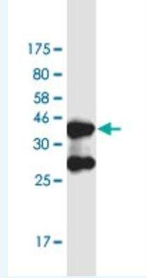 Western Blot: DHX38 Antibody (3B9) [H00009785-M02-100ug]