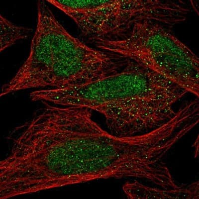 Immunocytochemistry/ Immunofluorescence: DHX38 Antibody [NBP1-85269]