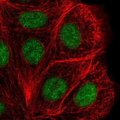 Immunocytochemistry/ Immunofluorescence: DHX38 Antibody [NBP2-58971]